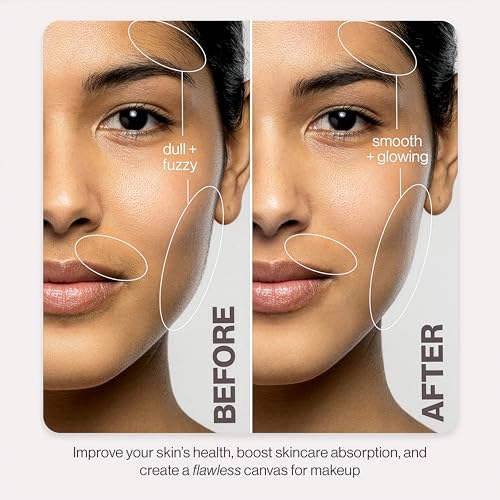 DERMAFLASH LUXE+ Sonic Dermaplaning Tool for Face