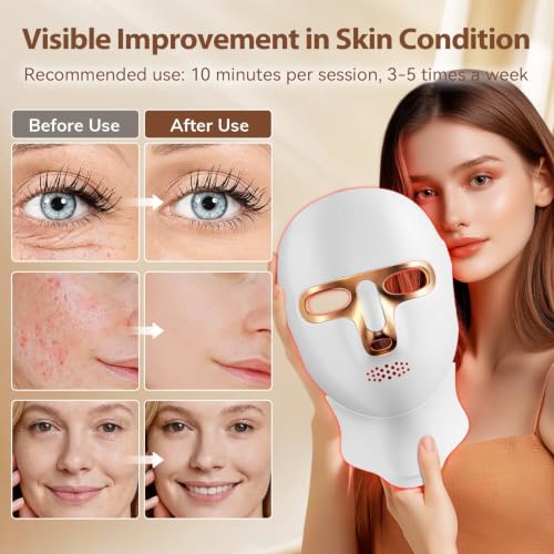 ONLUKY Cordless Red Light Therapy Mask for Face - Rechargeable LED