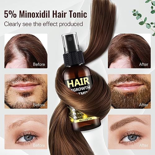 5% Minoxidil Hair Regrowth Spray for Men & Women