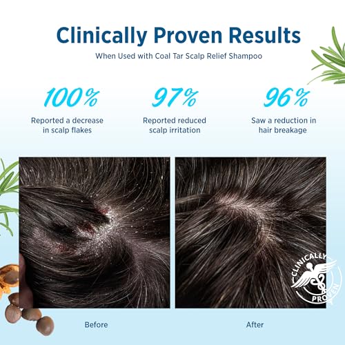 Roycederm Scalp Relief Conditioner with Jojoba Oil & Aloe Vera