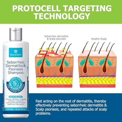 Roycederm Psoriasis Shampoo with Scalp Massager - Itchy Relief
