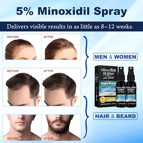 5% Minoxidil Hair Growth Spray for Men & Women - 2 Pack