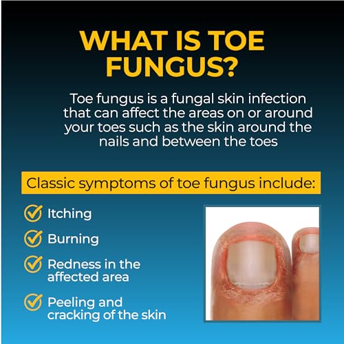 Fungi-Nail Maximum Strength Anti-Fungal Liquid Treatment - 1 Oz