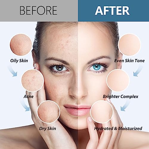 Jelly Mask Hydrating Deep Cleaning Detoxing Healing and Relaxing Premium Modeling Rubber For Facials Professional Set - 2 Treatments(Hyaluronic Acid,VC)