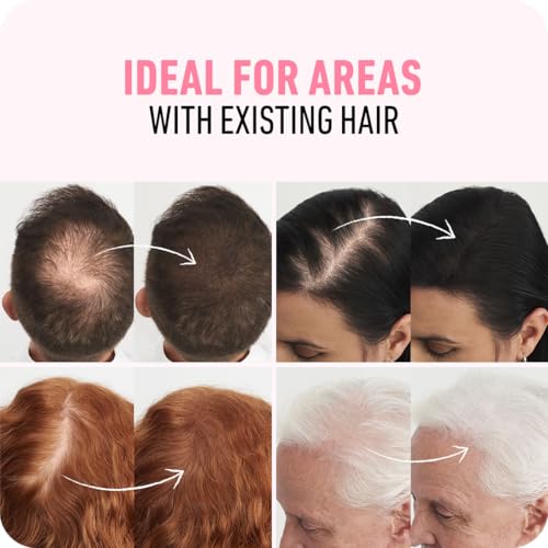 Boldify Hair Fibers Medium Brown 28g - Fuller Hair Instantly