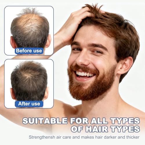 Root Activator Shampoo for Men & Women - Strengthening Formula for Thinning Hair