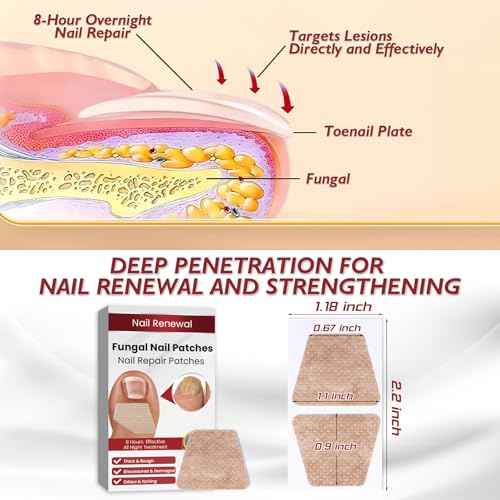 Fungus Nail Treatment Patch, Foot Fungus Treatment Extra Strength, Nail Fungal Patches for Toenail, Fungus Nail Treatment, Toe Nail Fungus Treatments, Yellow Toenail Patch for Fungi Nail