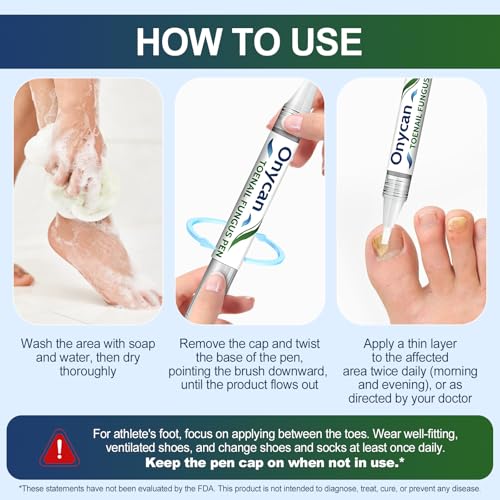 Toenail Fungus Treatment Pen 25% Undecylenic Acid - 5 Pack