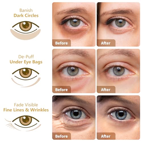 Under Eye Patches(30 Pairs), Eye Mask Patches with 24K Gold, Hyaluronic Acid & Rose, Under Eye Mask for Dark Circles, Puffy Eyes, Under Eye Bags, Wrinkles, Eye Treatment Skin Care for Men & Women Gift