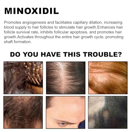 Hair Growth Serum with 5% Minoxidil & Biotin for Men Women