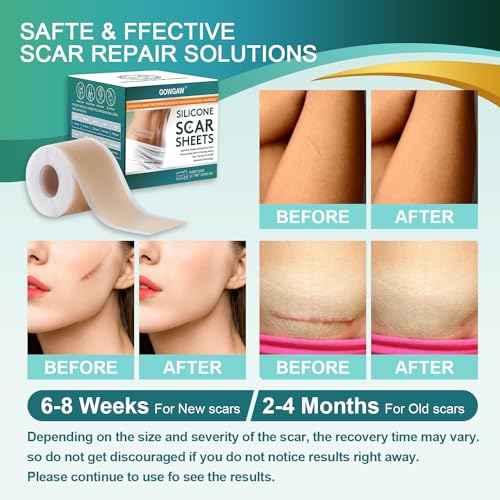 Medical Grade Silicone Scar Sheets, Silicone Scar Tape (1.6¡±x 60¡± Roll-1.5M), Professional Scar Removal Treatment, Reusable Silicone Scar Strip for Keloid, C-Section, Surgery, Burns, Acne Etc