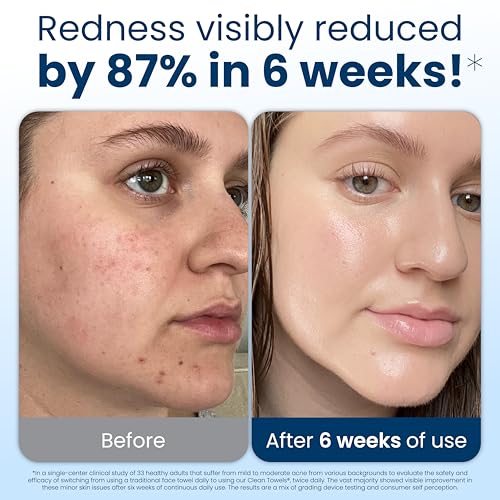 Clean Skin Club Clean Towels XL¢ç, 100% USDA Biobased Face Towel, Disposable Face Towelette, Eczema Association Accepted, Makeup Remover Dry Wipes, Ultra Soft, 50 ct per pack, 4 Packs, 200 Ct Total