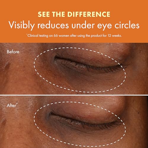 Origins GinZing Eye Cream - Vitamin C & Caffeine Dark Circle Reducer, 0.5 Oz