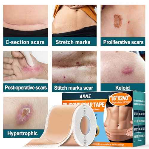 Arme Silicone Scar Tape, 1.6" x 240" Silicone Scar Sheets(2 Rolls-6M), Medical Grade Scar Tape Removal Sheets for Surgical Scars, Reusable Scar Removal Strips for Tummy Tuck C-Section Keloid
