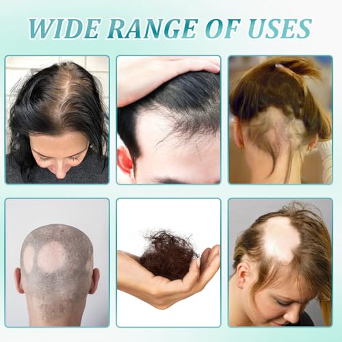 5% Minoxidil Hair Growth Scalp Massage Cream, Anti Loss Treatment for