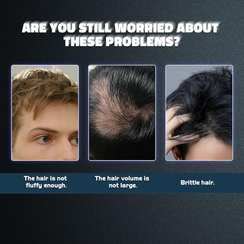 5% Minoxidil Hair Growth Serum for Men & Women - 3 Bottles