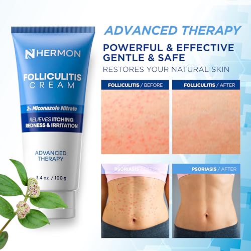 Hermon Folliculitis Cream 100g | Scalp, Face & Body