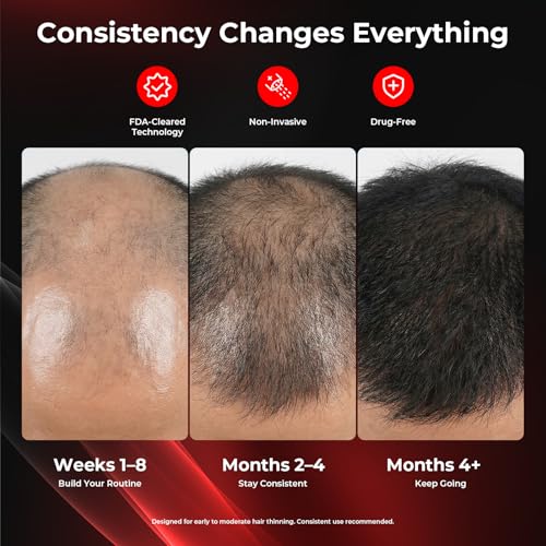 CAYAMA Red Light Hair Growth Cap - 528 LED Emitters