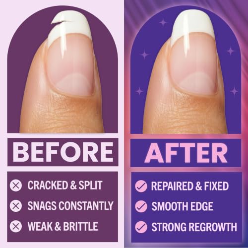 Nail Repair Kit for Broken Nails – Silk Wrap, Glue & File