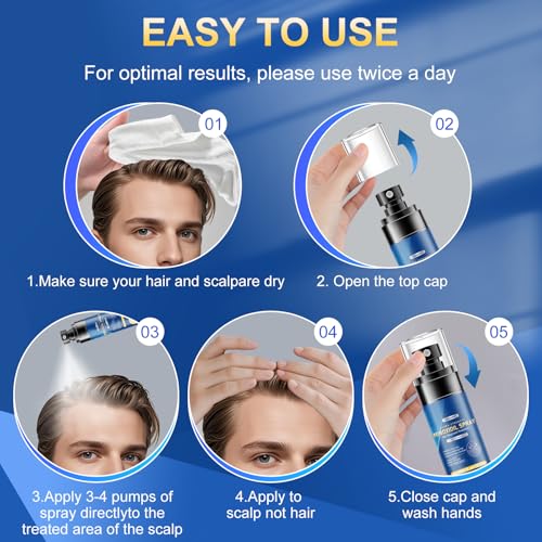5% Minoxidil Spray for Men - Hair Growth Treatment