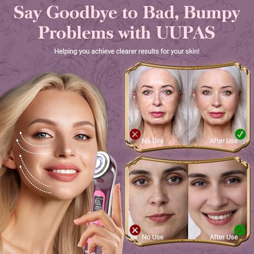UUPAS Smart Photon Micro-Current LED Red Blue Light Therapy Wand for Face - Microcurrent Facial Device