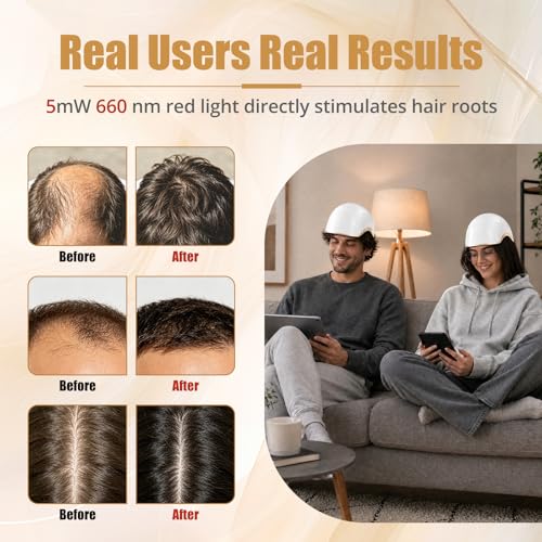 Hair Growth Device with Laser Red Light Therapy - Rechargeable LLLT