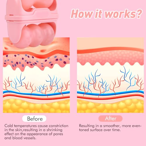 Fronnor Ice Roller for Face - Cooling Skin Massager