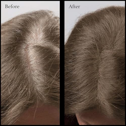 NuBeauti Light Brown Root Touch Up Powder - Natural Hairline Concealer, Talc-Free, Long-Lasting, No Brush Needed