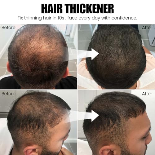 Hair Thickening Fibers Spray – Root Touch Up & Coverage