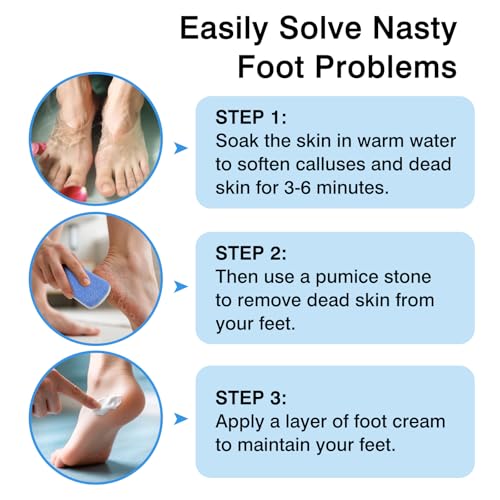 Dual-Sided Glass Pumice Stones for Callus Removal - 2-Pack