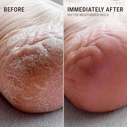 VOESH Solemate Heel Repair Balm | Cracked Heel Moisturizer