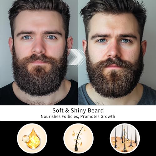 Sandalwood Beard Oil for Men - Beard Softener Moisturizer Thickener Strengthen Coarse Hair Mustache Oil with Argan Oil & Jojoba Oil Beard Conditioners & Oils Serum Care Gifts£¨1fl oz£©
