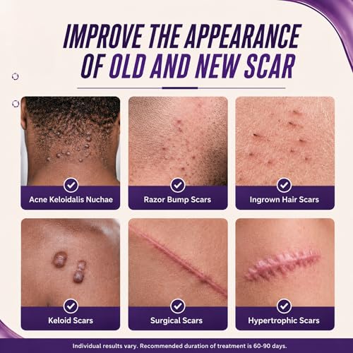 ABERA Kelo Scar Cream – Razor Bump & AKN Treatment for Men