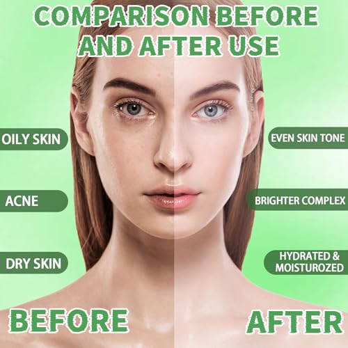 Jelly Mask Set,Hyalorunic Acid Jelly Masks For Facials Professional,Aloe Vera Hydro Jelly Mask,Hydrating Rubber Masks, Facial Mask Mixing Bowl Set And Headband,Birthday Gifts Set for Women