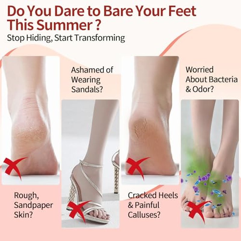 Rechargeable Electric Foot Callus Remover - 9 in 1 Pedicure Kit