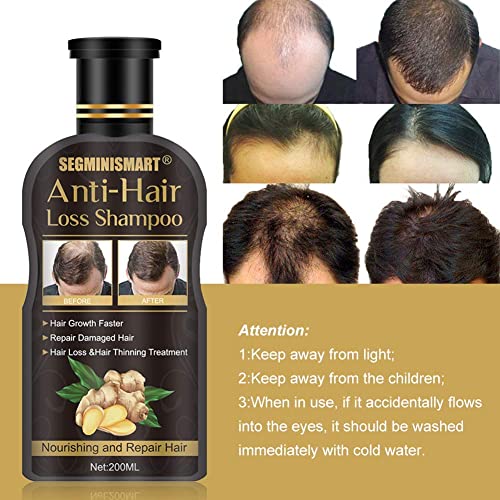 Hair Growth Shampoo,Anti-Hair Loss Shampoo,Hair Thickening Shampoo Helps Stop Loss, for Stronger, Thicker, Longer