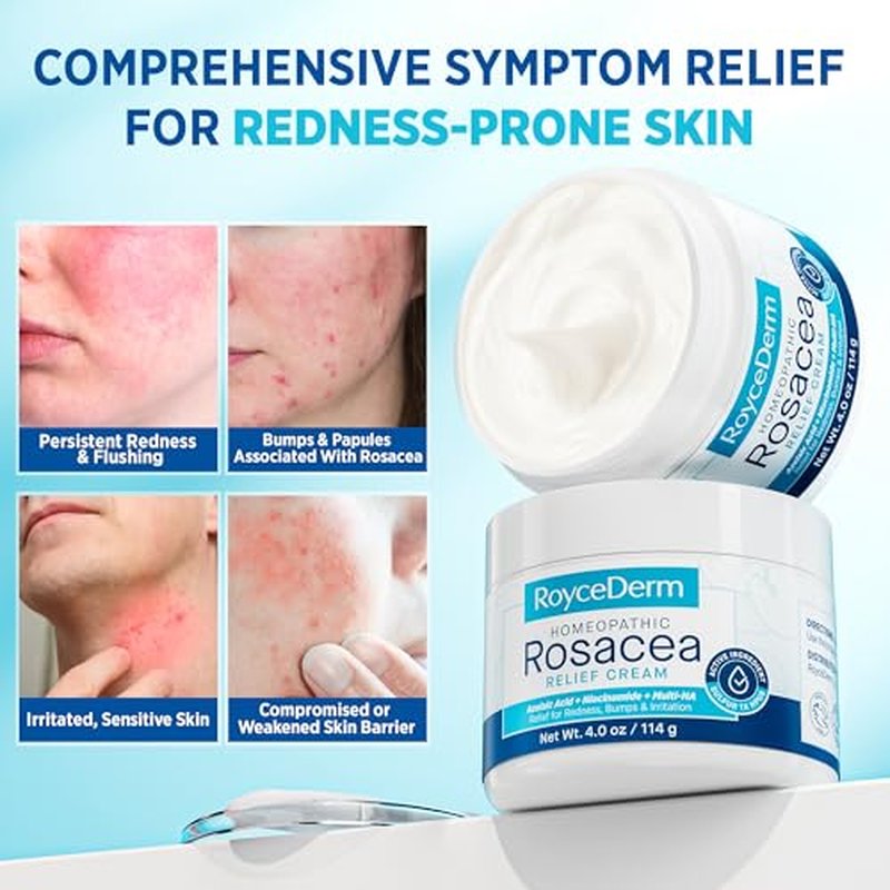 Roycederm Rosacea Treatment Cream with Azelaic Acid & Sulphur