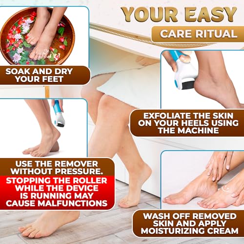 AZZORI Battery Operated Foot Callus Remover - Electric Pedicure File