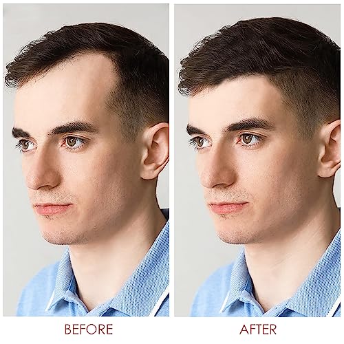 TOMUM Hair Growth Shampoo for Men and Women - 5% Foam Formula