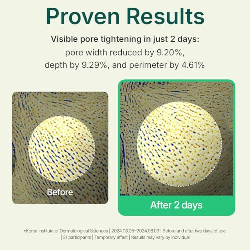 CENTELLIAN 24 Madeca Powder Tea Tree AC (Soothing Powder, 0.21 oz x 2) ? Oil Control & Pore-Tightening for Acne-Prone Skin, Korean Skincare with Hyper-TECA¢â Tea Tree & Allantoin