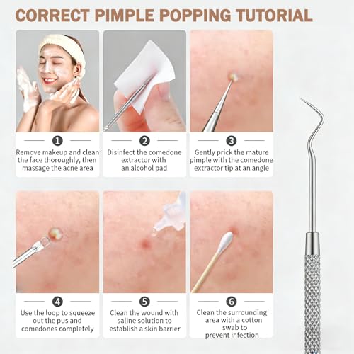 Blackhead Remover Tool Kit 6-Piece Stainless Steel Pimple Extractor