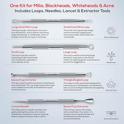Suvorna Pimple Popper Tool Kit, 4-Piece Blackhead & Milia Remover