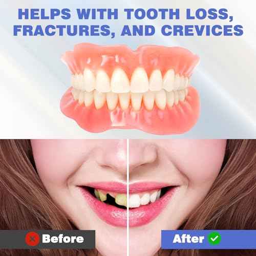 Veneers Teeth for Women, DIY Denture Kit, Do It Yourself False Teeth, Upper and Lower Matching Set, Fix Your Smile at Within Minutes, 1PCS