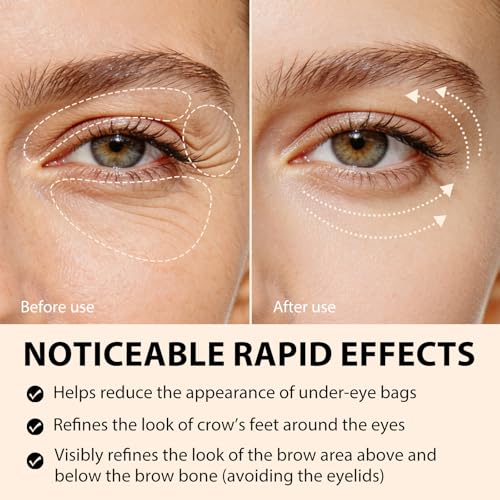 Instant Eye Tightener Cream with Retinol & Peptides
