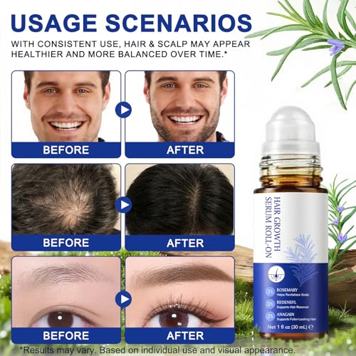 Rosemary Hair Growth Serum Roll-On, 1 Fl Oz