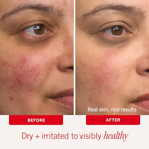 First Aid Beauty Ultra Repair Cream with Colloidal Oatmeal