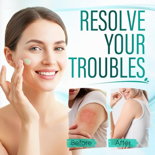 Intertrigo Relief Cream ? Intertrigo Cream for Belly Folds with 10% Undecylenic Acid & 15% Zinc Oxide, Fast-Drying, Non-Greasy Support for Friction-Prone Areas, 60ml (1)