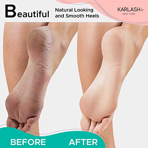 Karlash 2-Sided Foot Pumice Stone Callus Remover Scrubber (2 Pack)