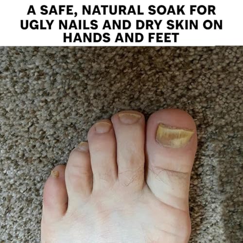 Long Creek Herbs 100% Natural Herbal Nail & Foot Soak Treatment