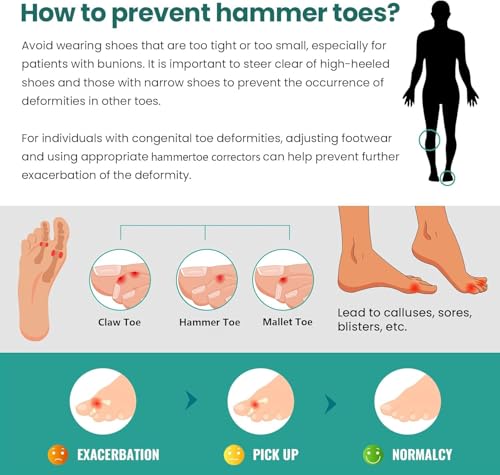 Welnove Green Hammer Toe Corrector Set - 6 Pairs Soft Gel Toe Splints for Realignment